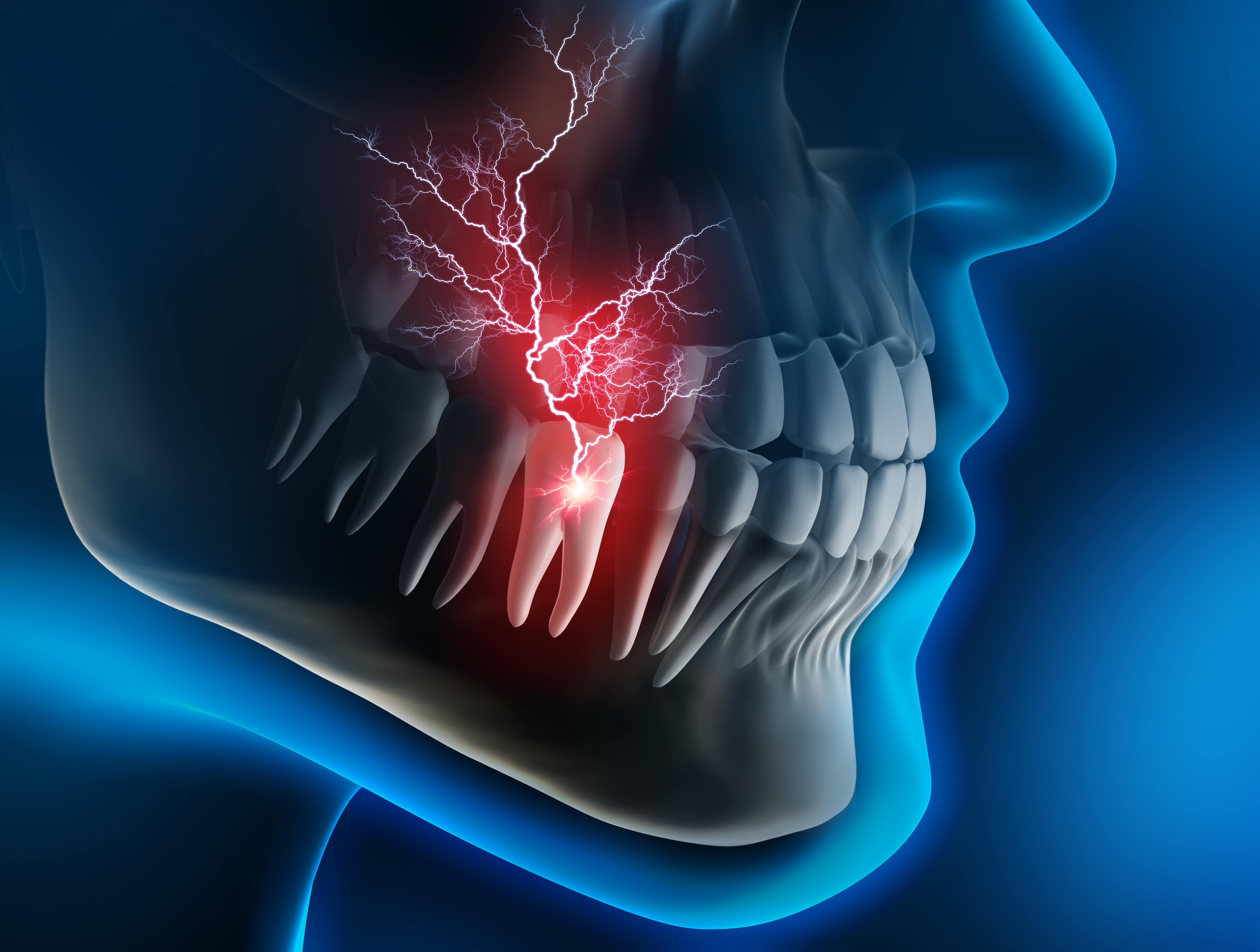 ROOT CANAL Cl nica Dental Roca Santiago